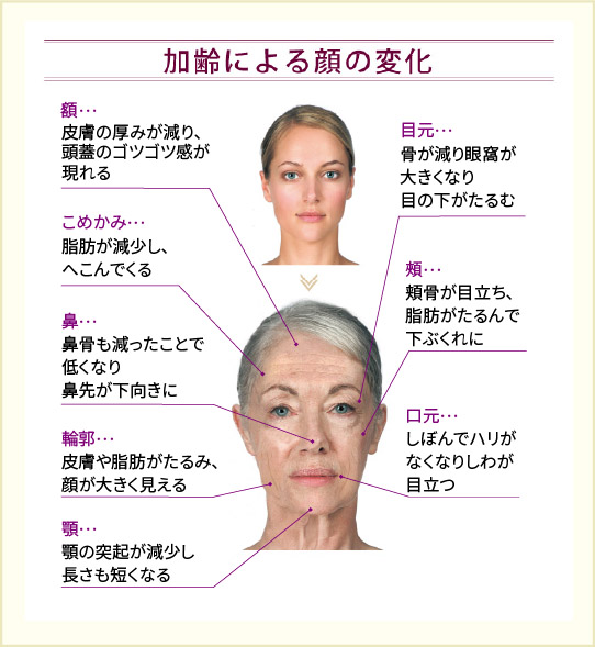 加齢による顔の変化