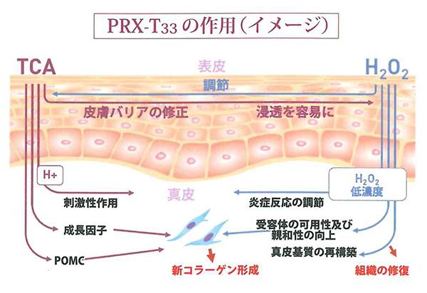 PRX-T33