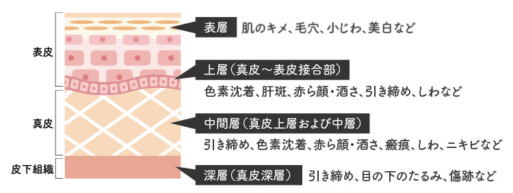 シルファームの効果のイメージ