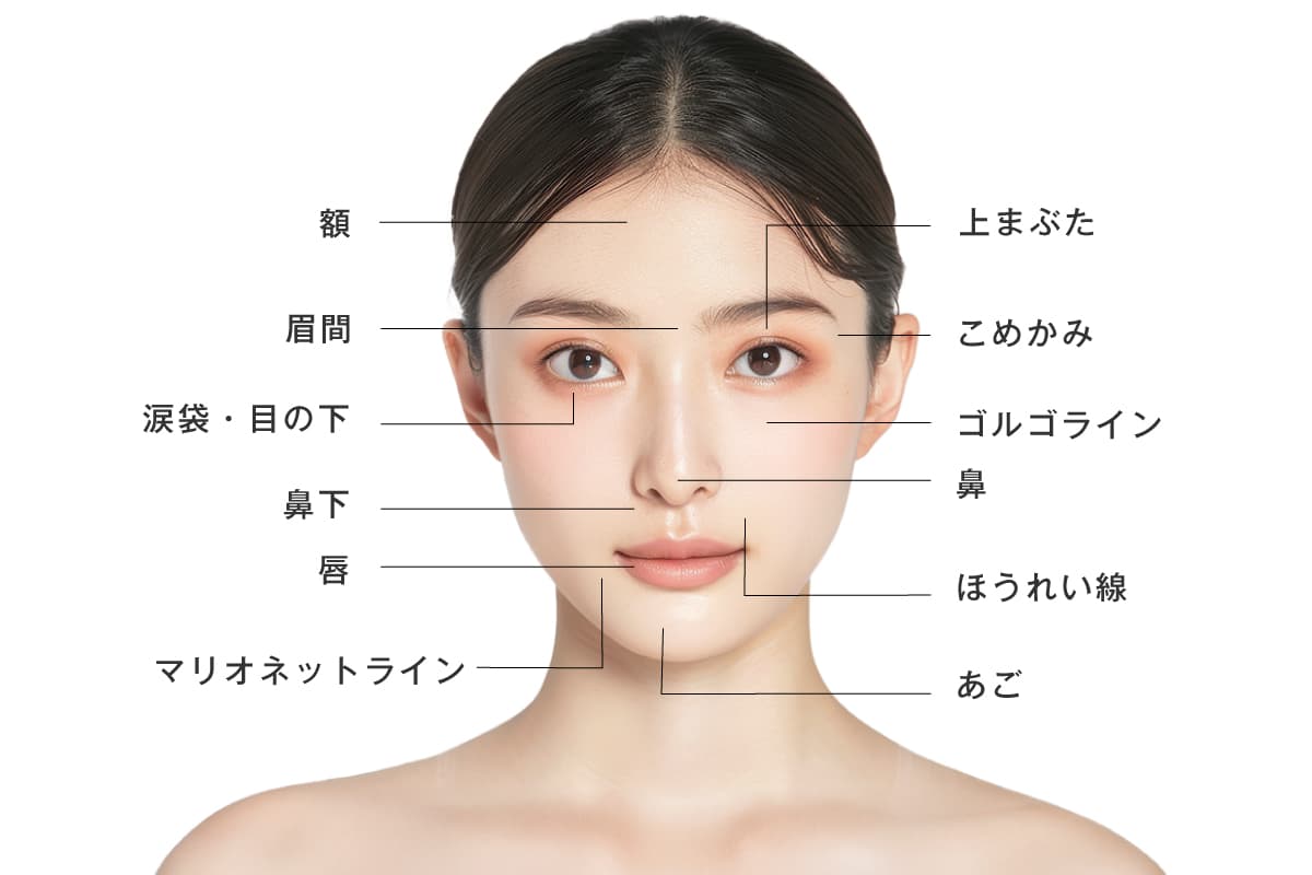 ヒアルロン酸の注入部位