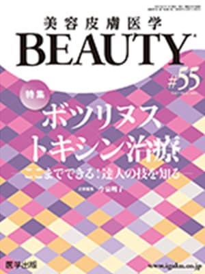 美容皮膚医学 BEAUTY ボツリヌストキシン治療