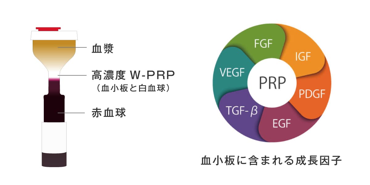 PRPの仕組み