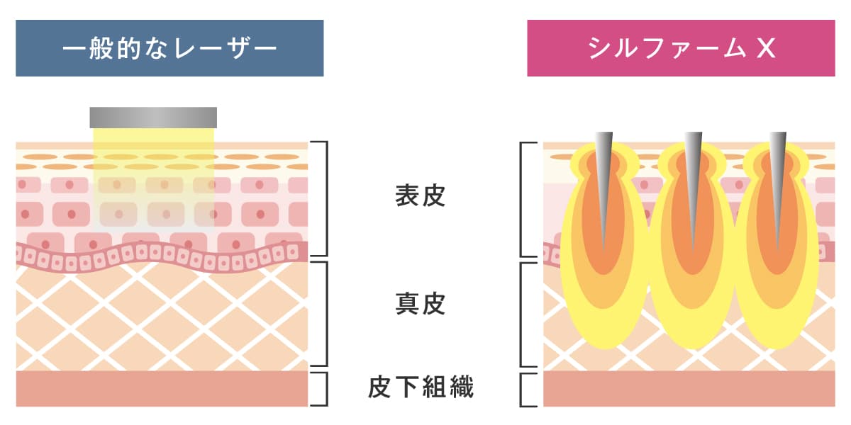 シルファームの仕組み