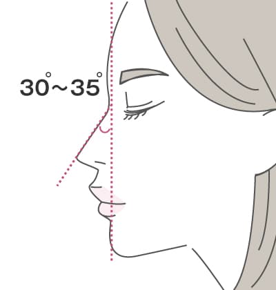 日本人女性における鼻の美的基準。30~35°