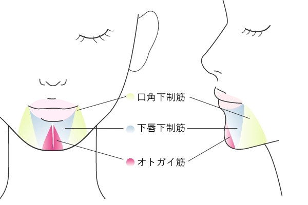 あごのボトックスの注入部位