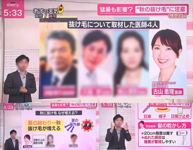 news every. 2025年9月4日放送「秋の抜け毛に注意」