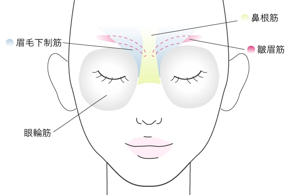 眉間のボトックスの注入部位の図解イラスト