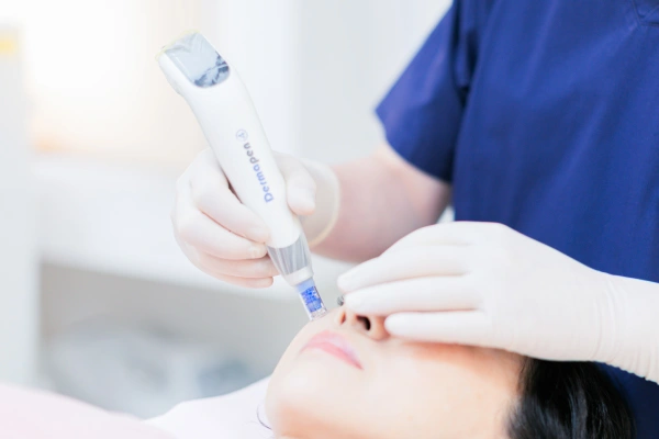 ダーマペンの施術風景