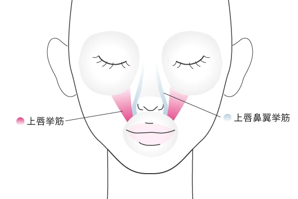 ガミースマイルの注入部位