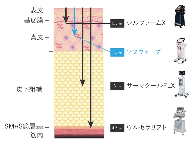 ソフウェーブの効果の図解