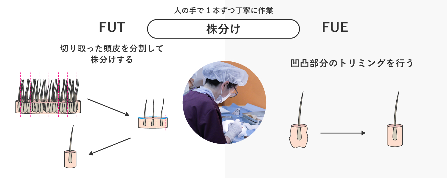 株分けありと株分けなしの図解イラスト