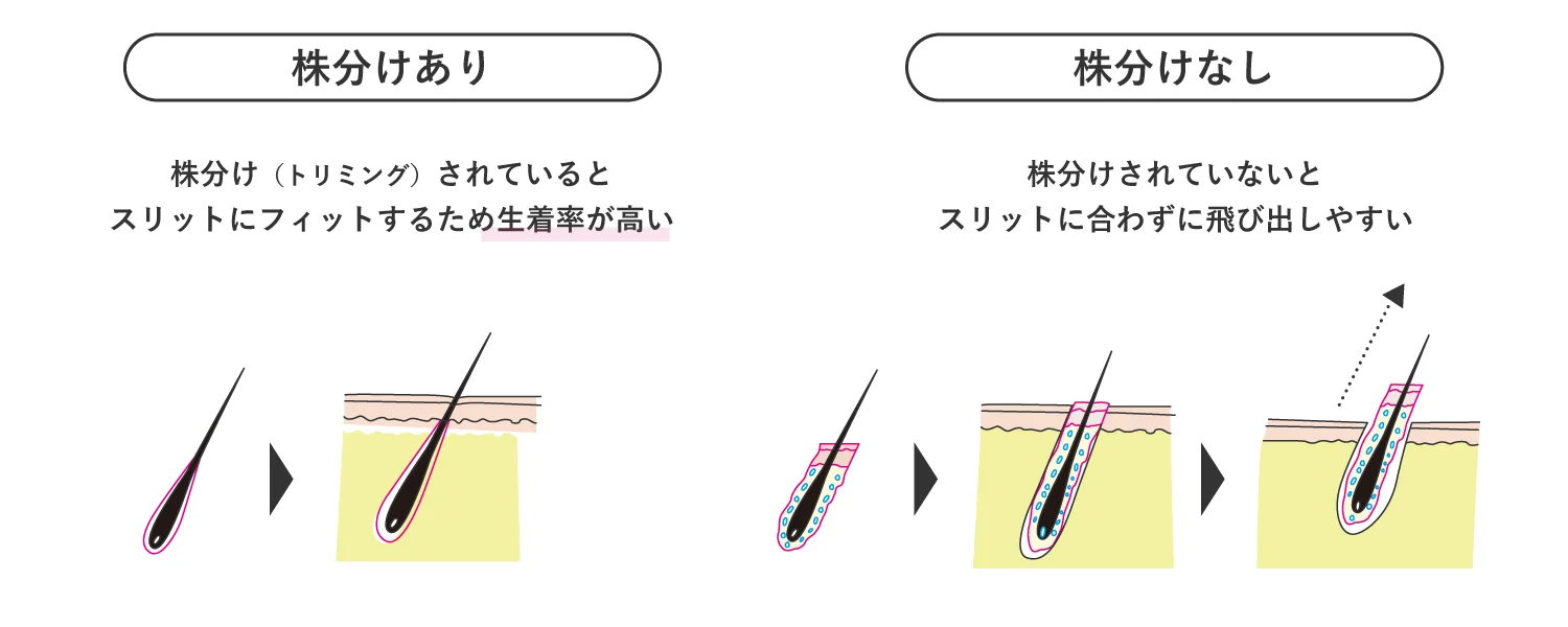 株分けありと株分けなしの図解イラスト
