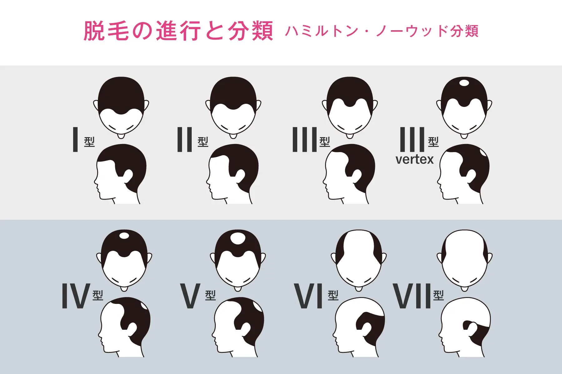 ハミルトンノーウッドの分類についての解説イラスト